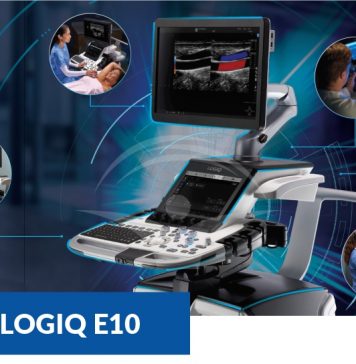 Medicover România își consolidează activitatea de imagistică prin achiziționarea unui ecograf de ultimă generație