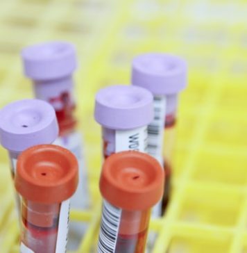 CGMB: 2.500 de persoane vor putea beneficia de programe pentru recuperare oncologică, iar 400 de un program pentru testarea genetică la cancerul de sân