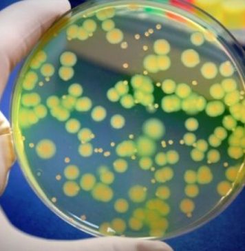 STUDIU/ Bolnavii de SIDA, ameninţaţi de o formă gravă de Mpox