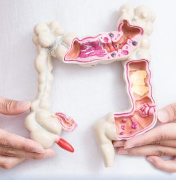 CJ Ilfov, detalii despre înscrierea în programul de prevenție și depistare precoce a leziunilor precanceroase colorectale