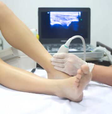 Specialitate nouă la Centrul de Sănătate „Sfântul Nectarie” – Chirurgia Vasculară