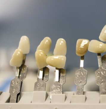 Când sunt recomandate fațetele dentare și ce opțiuni ai în București?