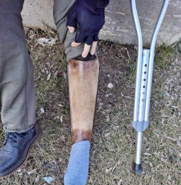 FOTO/ Cerșetori care se prefac a avea mâini amputate și picioare contorsionate, depistați de polițiștii locali din Sectorul 6